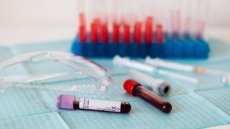 Először találtak emberi vérben mikroműanyagot