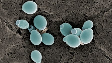 Megugrott a gombás megbetegedések száma a Covid-járvány és az éghajlatváltozás miatt