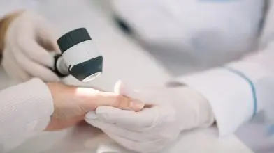 Jön a nyár, a napsütés! Te voltál már melanomaszűrésen?